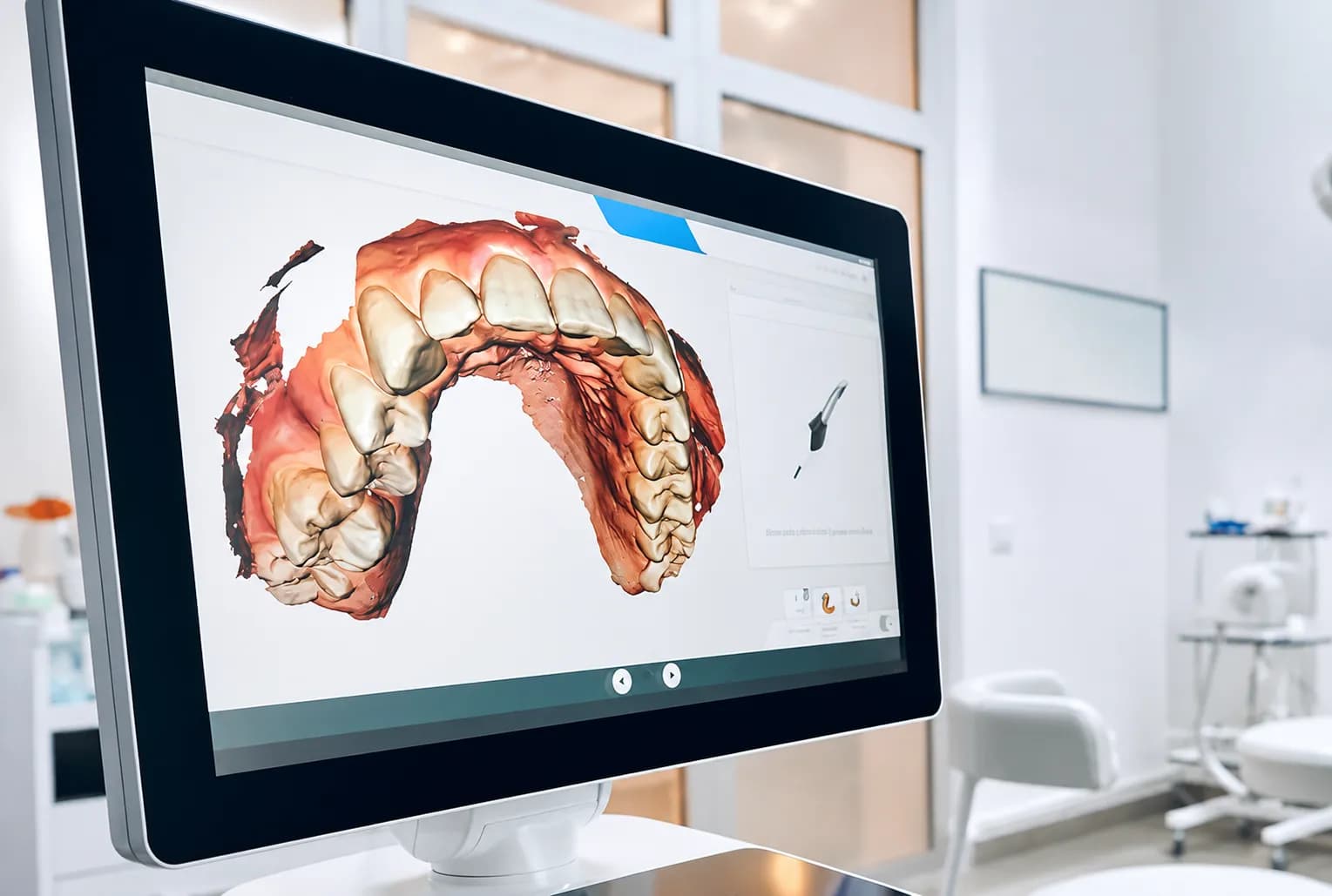 iTero 3D digital scanner