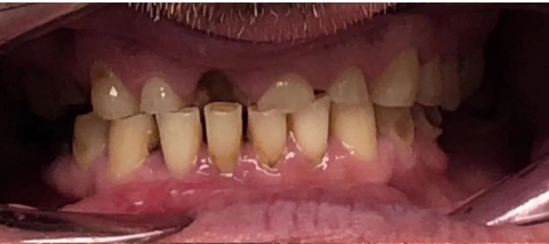Before: Full Smile Makeover