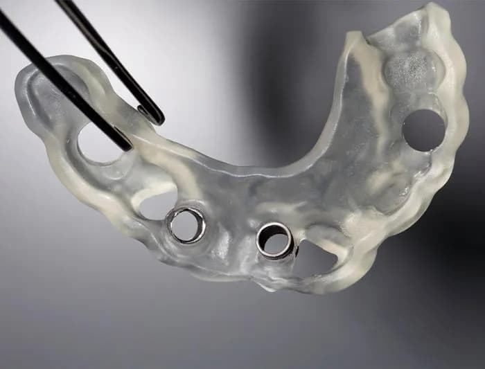 Implant Placement