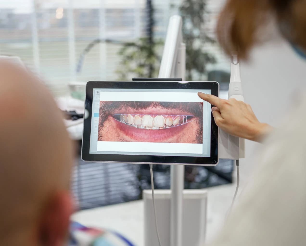 Dentist consulting with patient about cosmetic goals