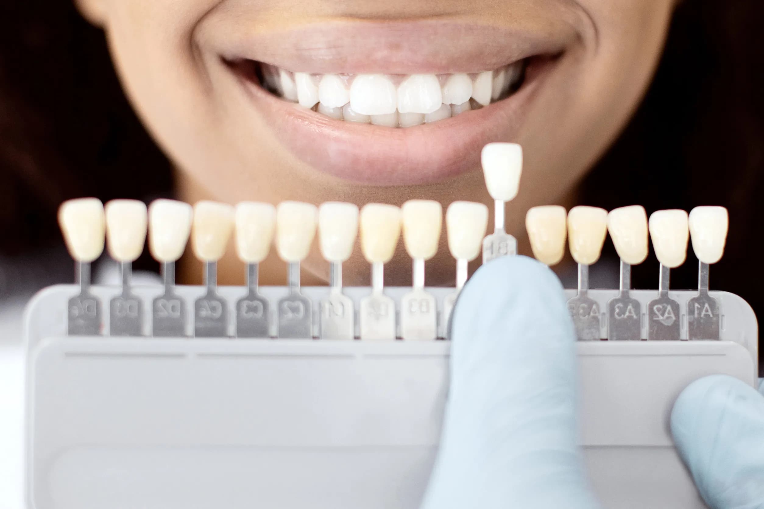 Dental team executing the approved smile design treatment