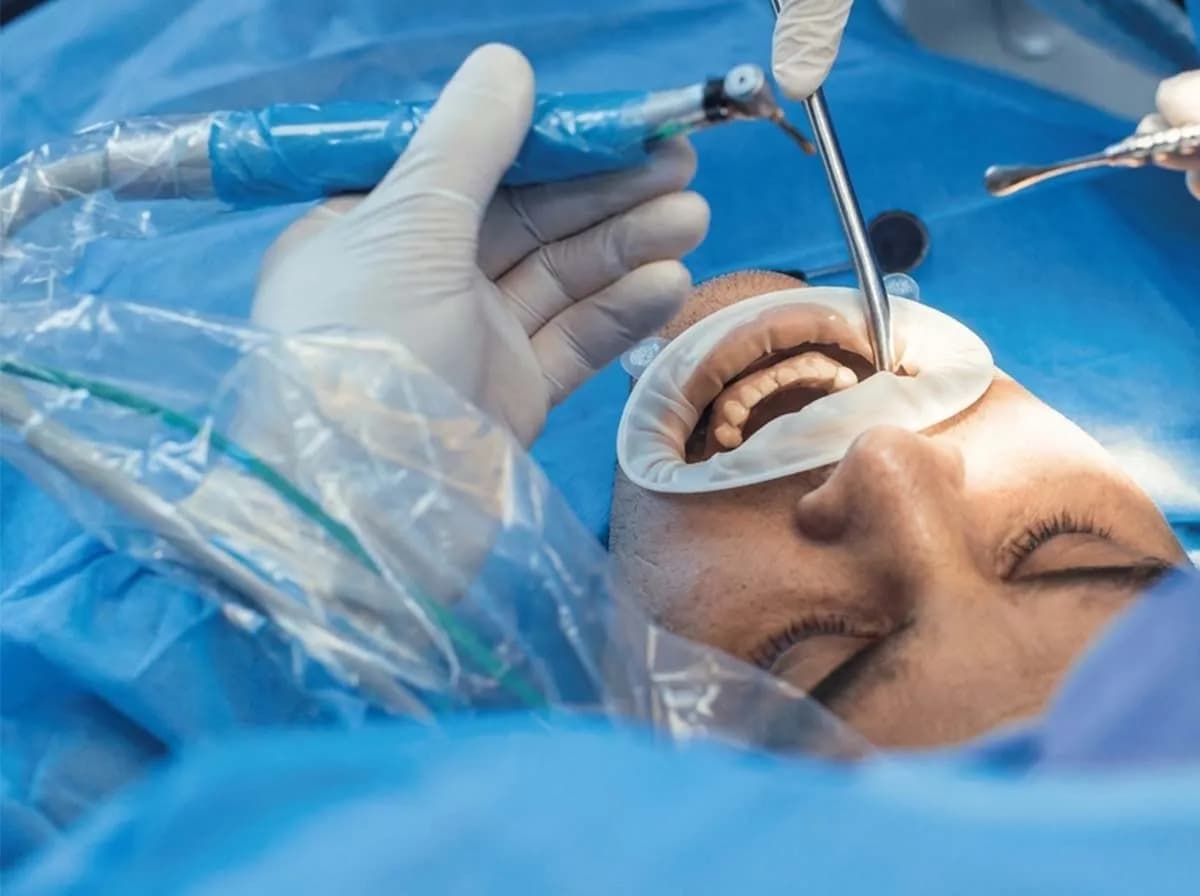 Extraction