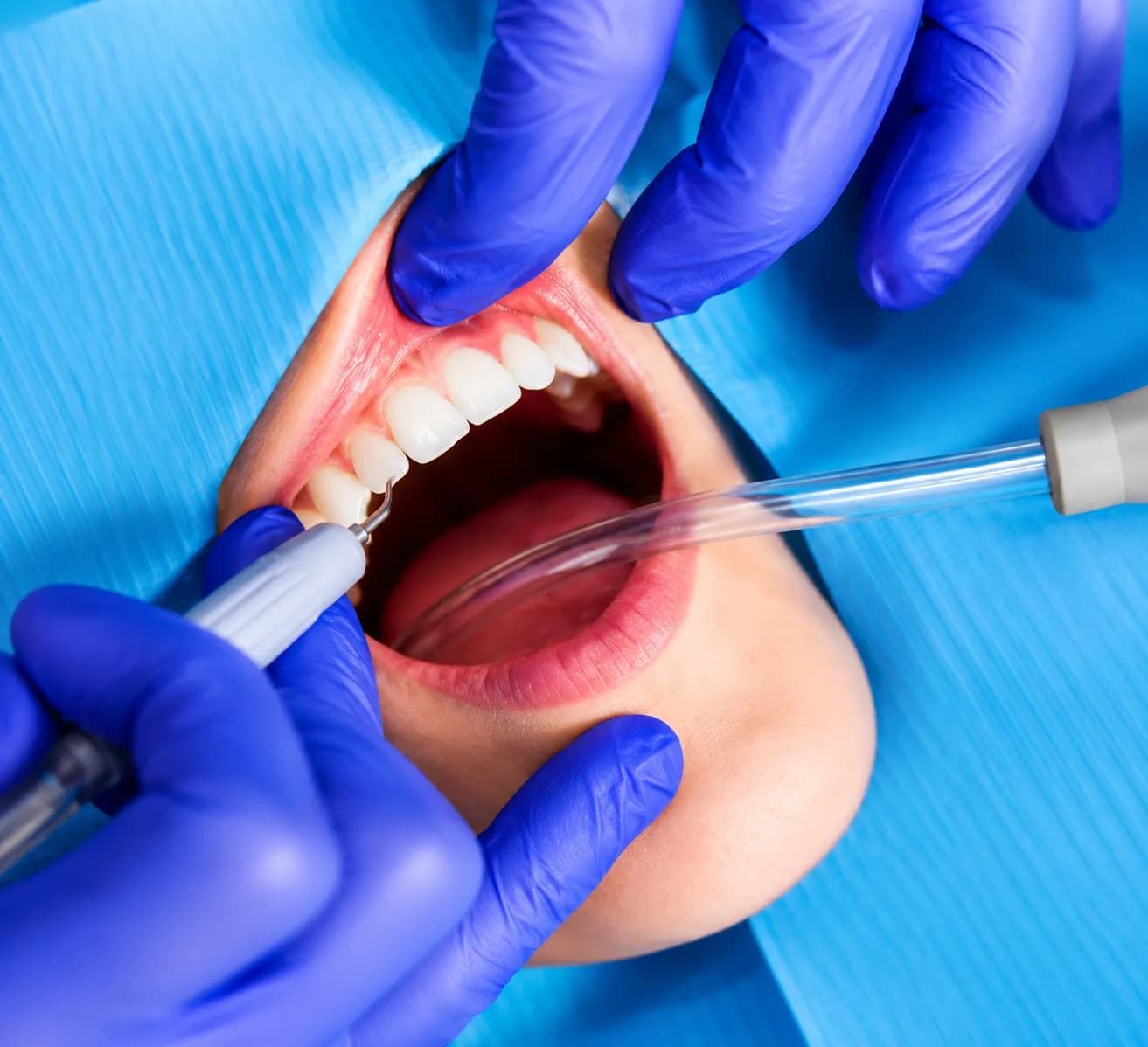 Dentist performing periodontal gum treatment on a patient