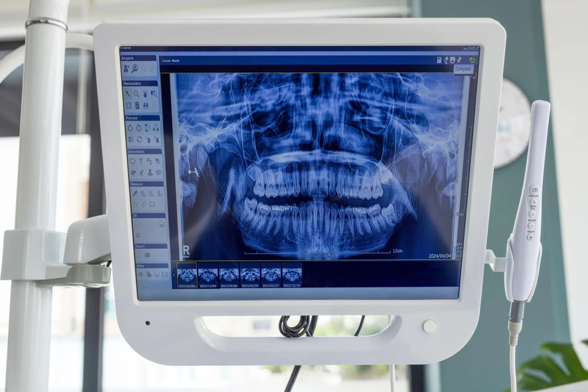 Dentist performing a thorough dental evaluation