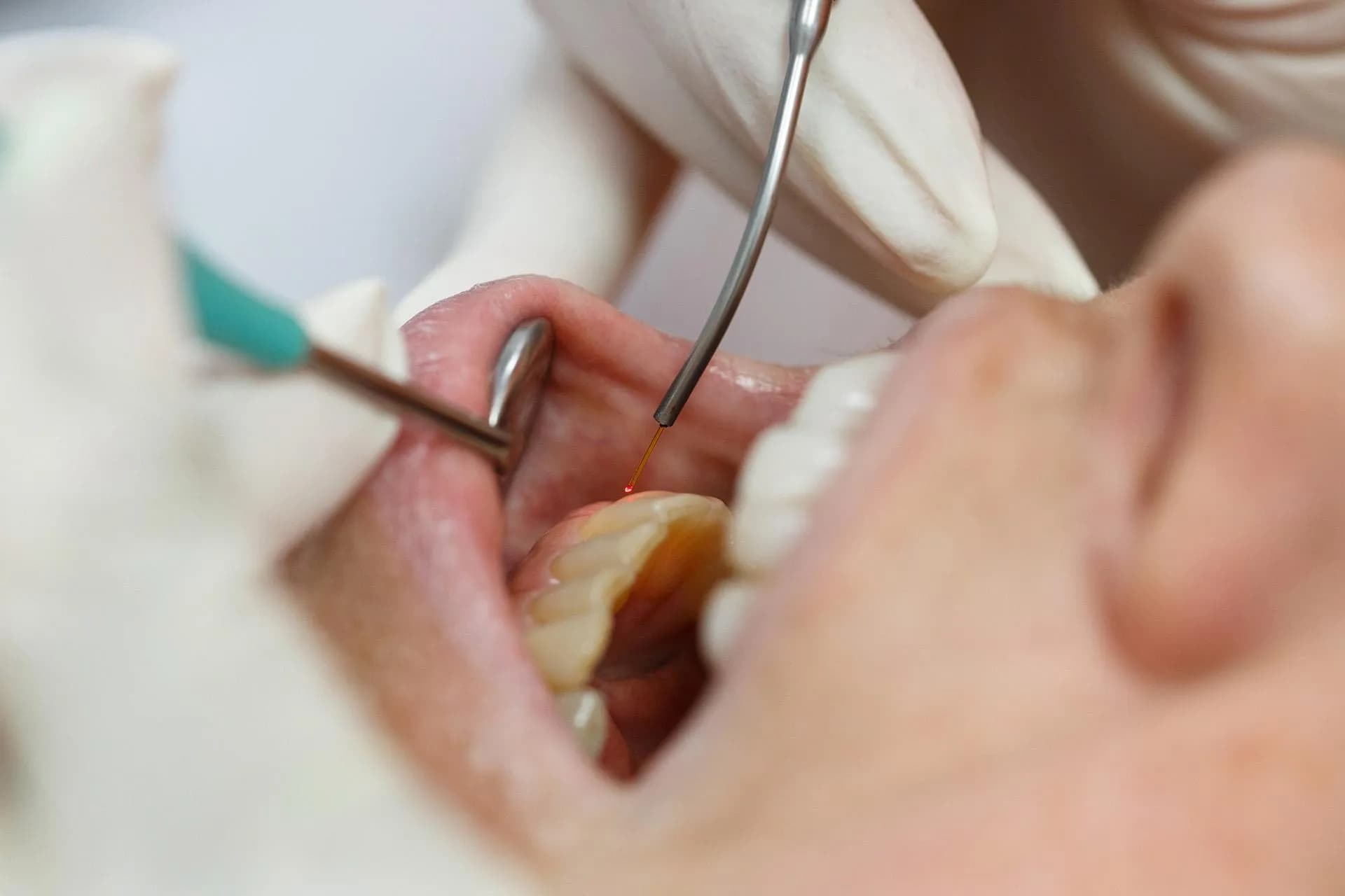 Modern dental operatory prepared for a comfortable procedure