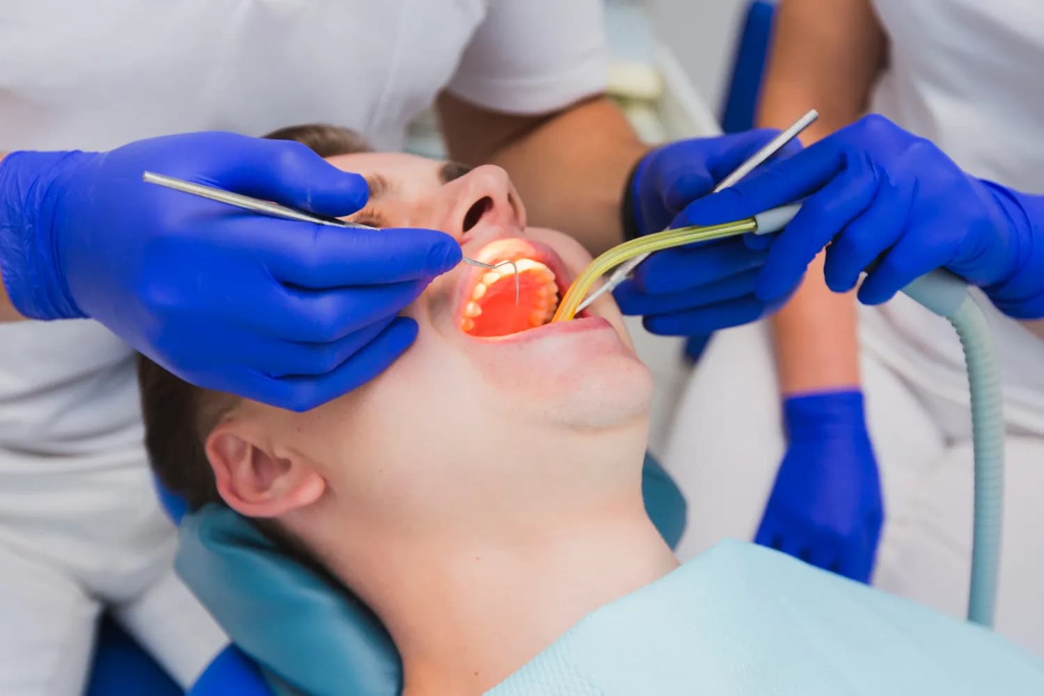 Root Canal Treatment process