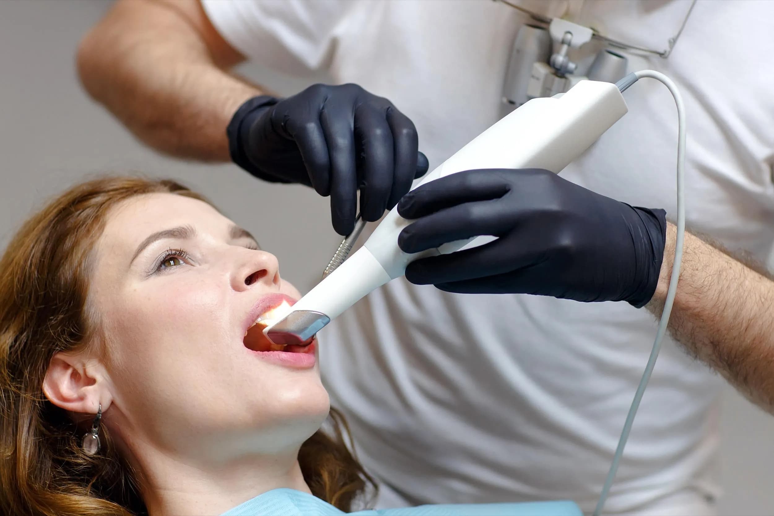 Digital 3D dental scanning for custom appliance fabrication