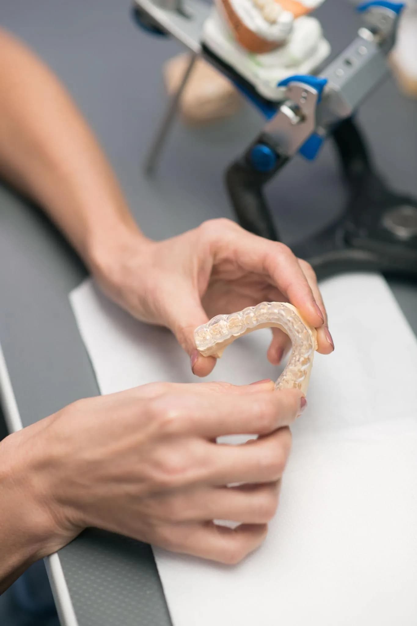 Custom dental molds for sleep apnea oral appliance