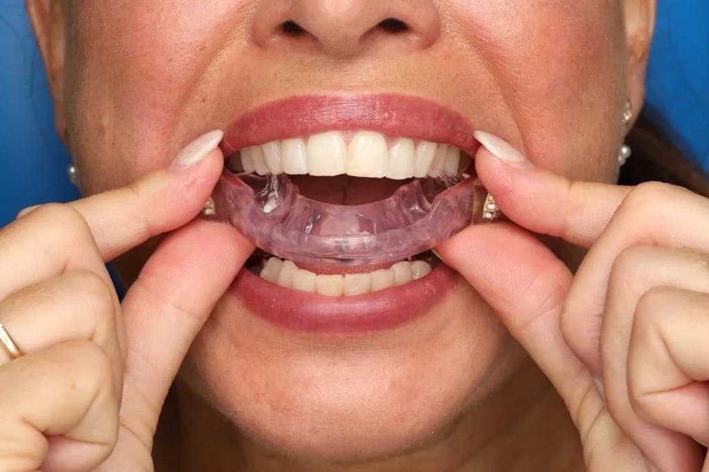 Dentist fitting and adjusting oral appliance for patient