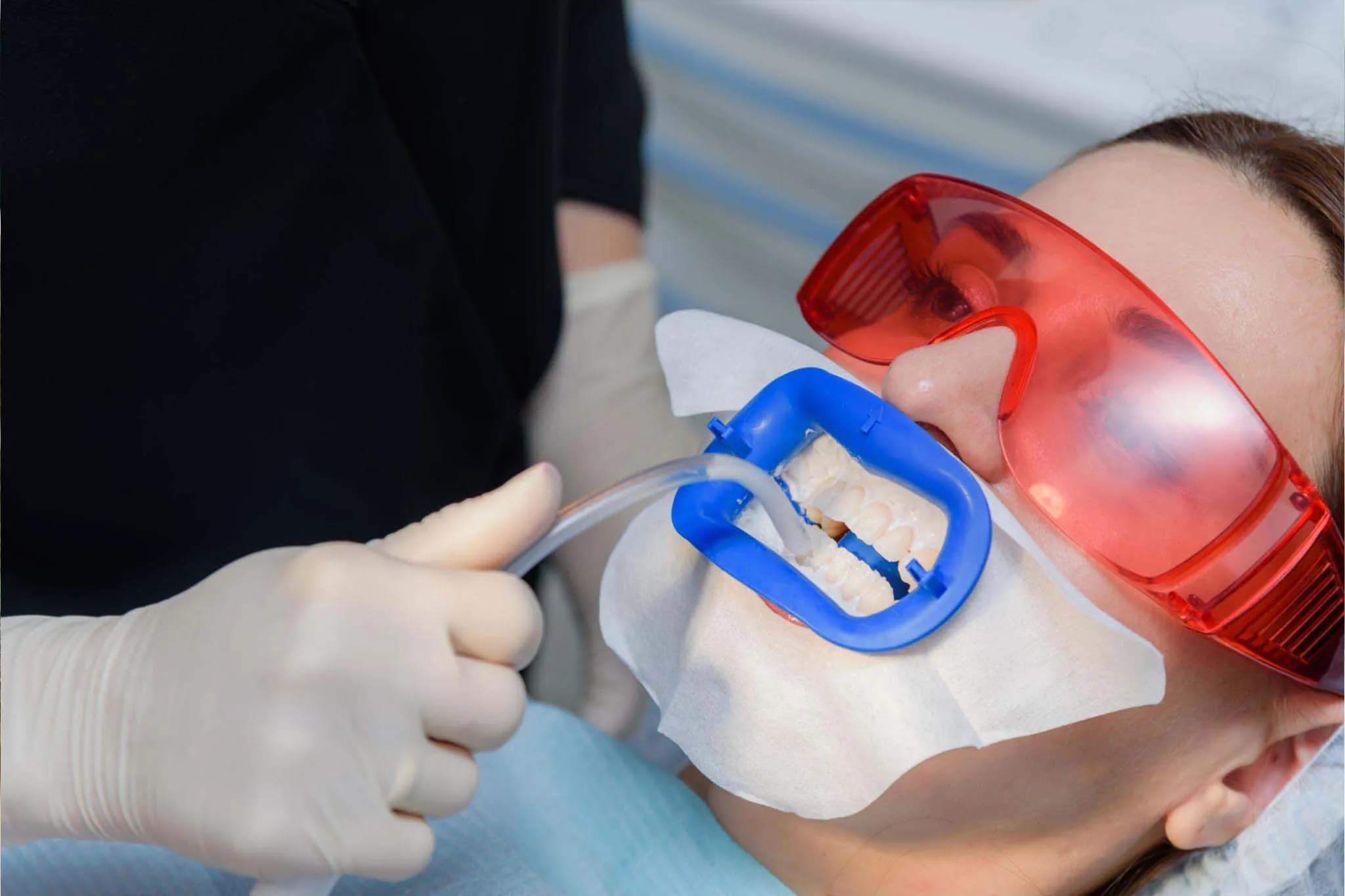 Dental tools and mirrors prepared for whitening procedure